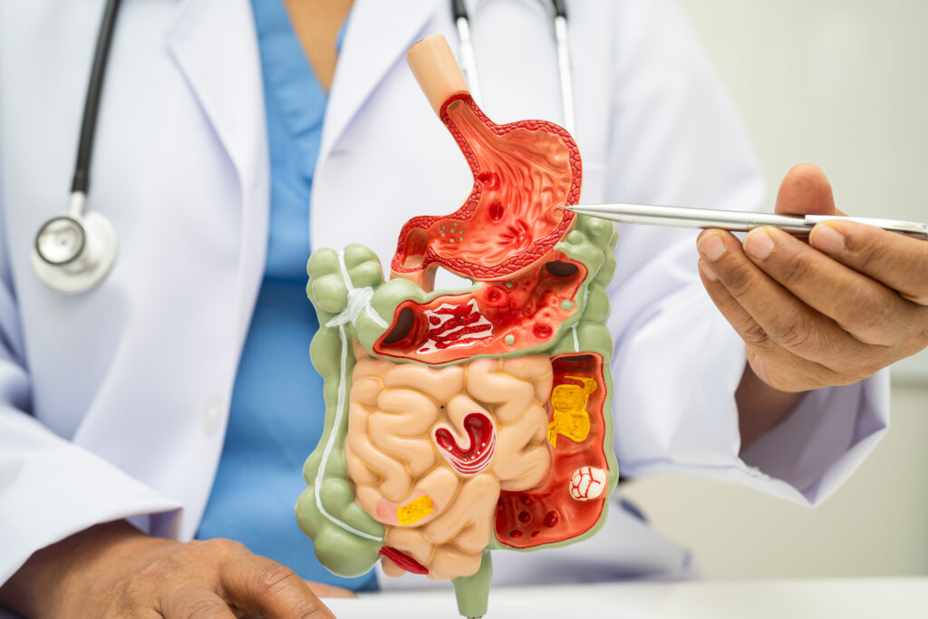 Best Gastroenterology Treatment in JP Nagar